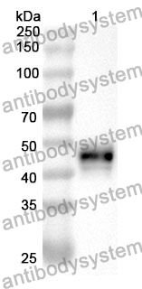 Anti-ADAR/IFI4 Polyclonal Antibody