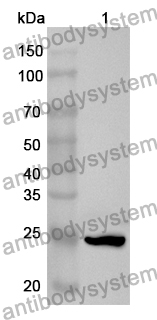 Anti-Human CDH6/Cadherin-6 Polyclonal Antibody