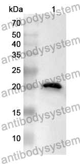 Anti-FOXA3 Polyclonal Antibody