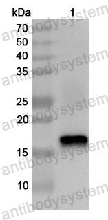 Anti-Human SNU13 Polyclonal Antibody