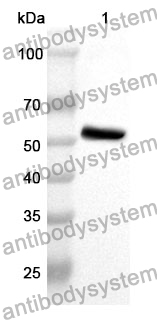 Anti-OXCT1 Polyclonal Antibody