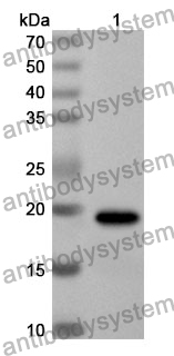 Anti-Human DLX5 Polyclonal Antibody