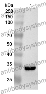 Anti-Human NDUFV3 Polyclonal Antibody