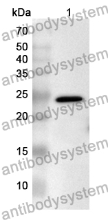 Anti-MARS1 Polyclonal Antibody