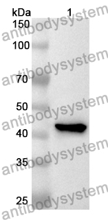 Anti-Human CTSW Polyclonal Antibody