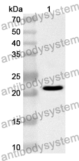 Anti-Human ARPP19 Polyclonal Antibody