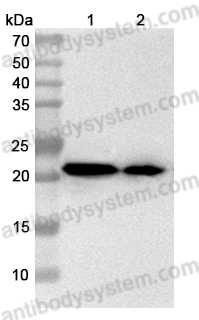 Anti-AP1S2 Polyclonal Antibody