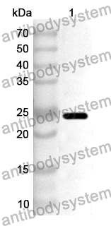 Anti-NME5 Polyclonal Antibody