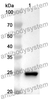 Anti-Human SOX10 Polyclonal Antibody