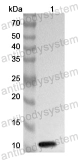 Anti-CLDN18/Claudin-18 Polyclonal Antibody