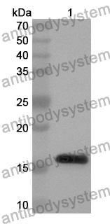 Anti-MAP3K7CL Polyclonal Antibody