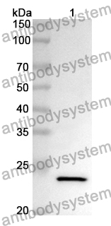 Anti-Human GSDMD Polyclonal Antibody