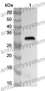 Anti-ANTXR2 Polyclonal Antibody