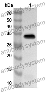 Anti-DEFA3 Polyclonal Antibody