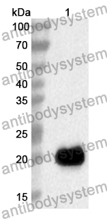 Anti-Human GNG2 Polyclonal Antibody