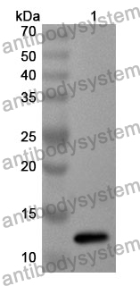 Anti-CD81 Polyclonal Antibody