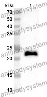 Anti-CD81 Polyclonal Antibody