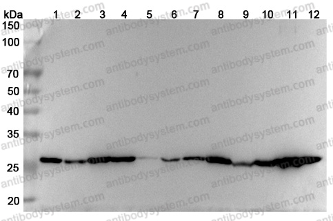 Anti-Human TPI1 Polyclonal Antibody