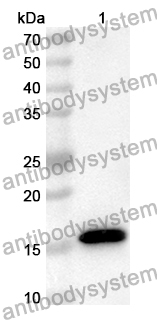 Anti-Human GABARAPL2 Polyclonal Antibody