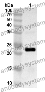 Anti-Human RAC3 Polyclonal Antibody