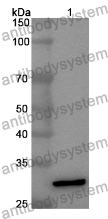 Anti-Human ZP1 Polyclonal Antibody