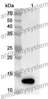 Anti-S100A10 Polyclonal Antibody