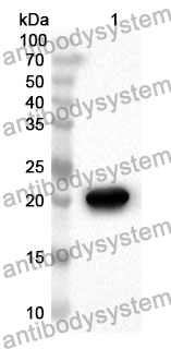 Anti-Human RAB8A Polyclonal Antibody