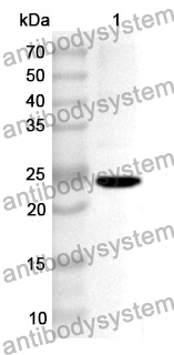 Anti-Human RAB2A Polyclonal Antibody