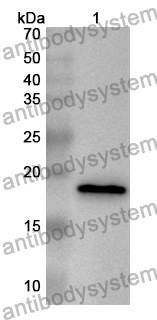 Anti-Human UBE2D3 Polyclonal Antibody