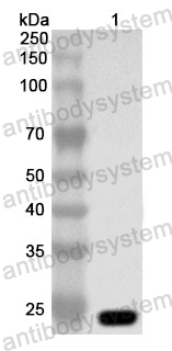 Anti-Human UBE2K Polyclonal Antibody