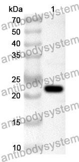 Anti-Human RAB14 Polyclonal Antibody