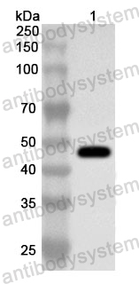 Anti-Human ACTR2 Polyclonal Antibody