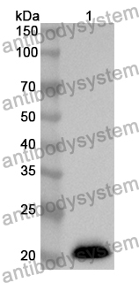 Anti-ABCE1 Polyclonal Antibody