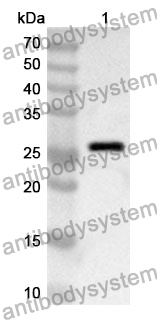 Anti-Human RPS3A Polyclonal Antibody