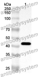 Anti-Human ATP6V0D1 Polyclonal Antibody