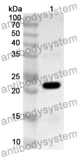 Anti-Human RND3 Polyclonal Antibody