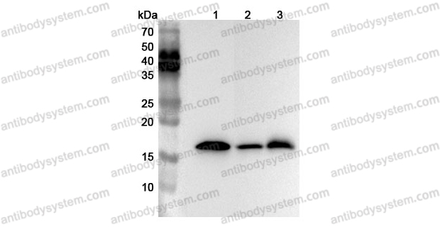 Anti-Human NCALD Polyclonal Antibody