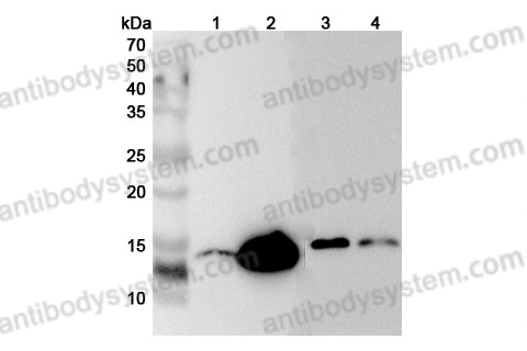 Anti-LYZ Polyclonal Antibody