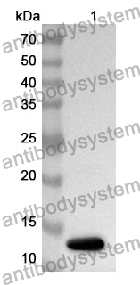 Anti-B2M Polyclonal Antibody