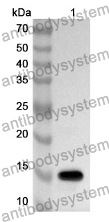 Anti-TGFB2 Polyclonal Antibody