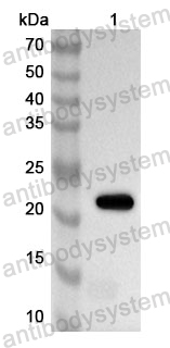 Anti-Human TIMM10 Polyclonal Antibody