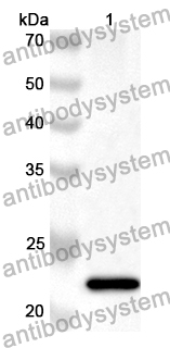 Anti-Human RPS7 Polyclonal Antibody