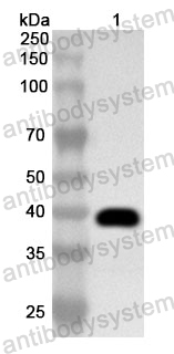 Anti-Human PPP1CB Polyclonal Antibody