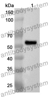 Anti-PSMC1 Polyclonal Antibody