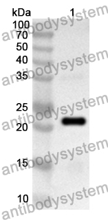 Anti-Human RPS8 Polyclonal Antibody