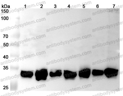 Anti-Human YWHAE Polyclonal Antibody