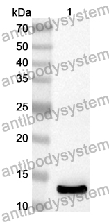 Anti-Human RPS14 Polyclonal Antibody