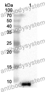 Anti-TMSB4X Polyclonal Antibody