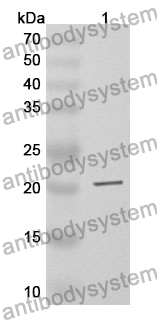 Anti-Human RPL7A Polyclonal Antibody