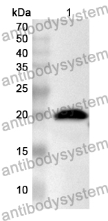 Anti-Human CNBP Polyclonal Antibody